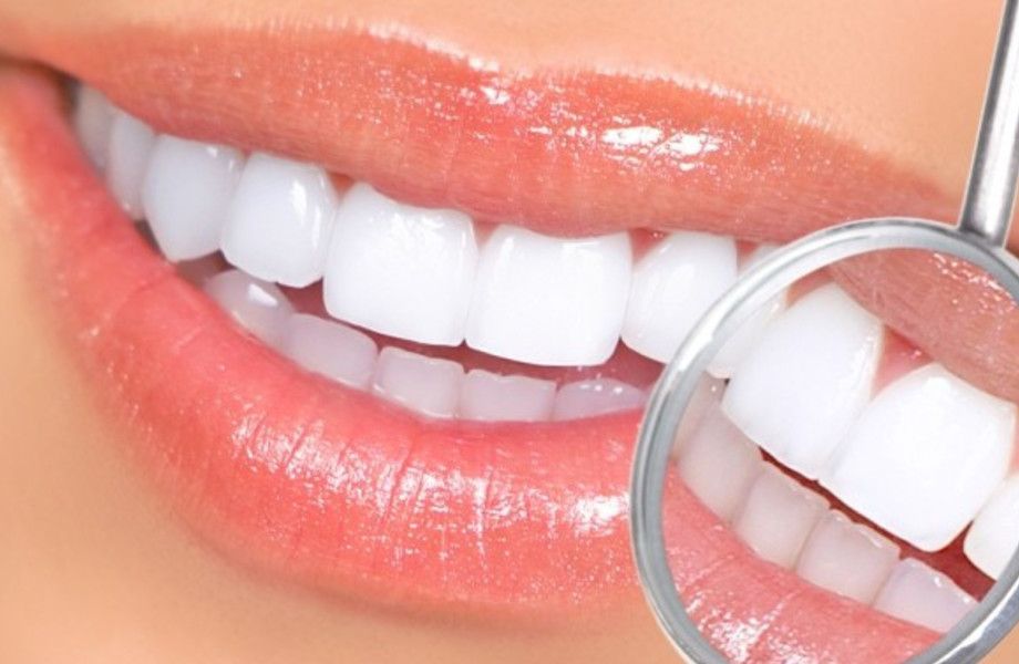 Студия косметического отбеливания зубов по уникальной методике 