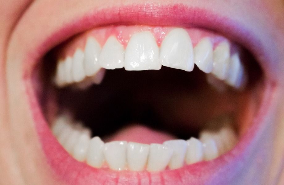 Студия косметического отбеливания зубов по уникальной методике 